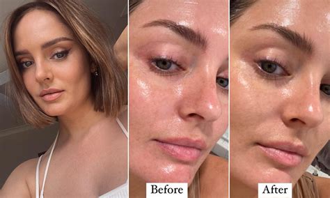 before and after chanel les beiges water fresh tint|chanel les beiges tinted moisturizer.